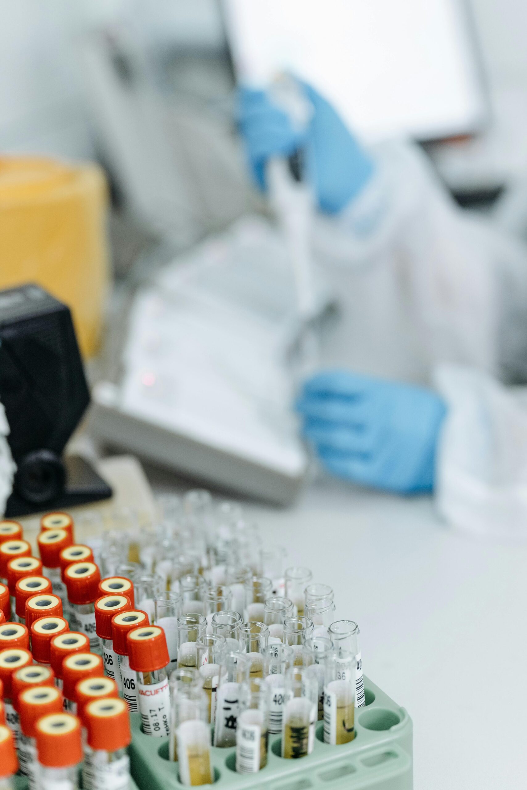 A laboratory scene featuring blood samples and a researcher using a pipette, ideal for medical research contexts.